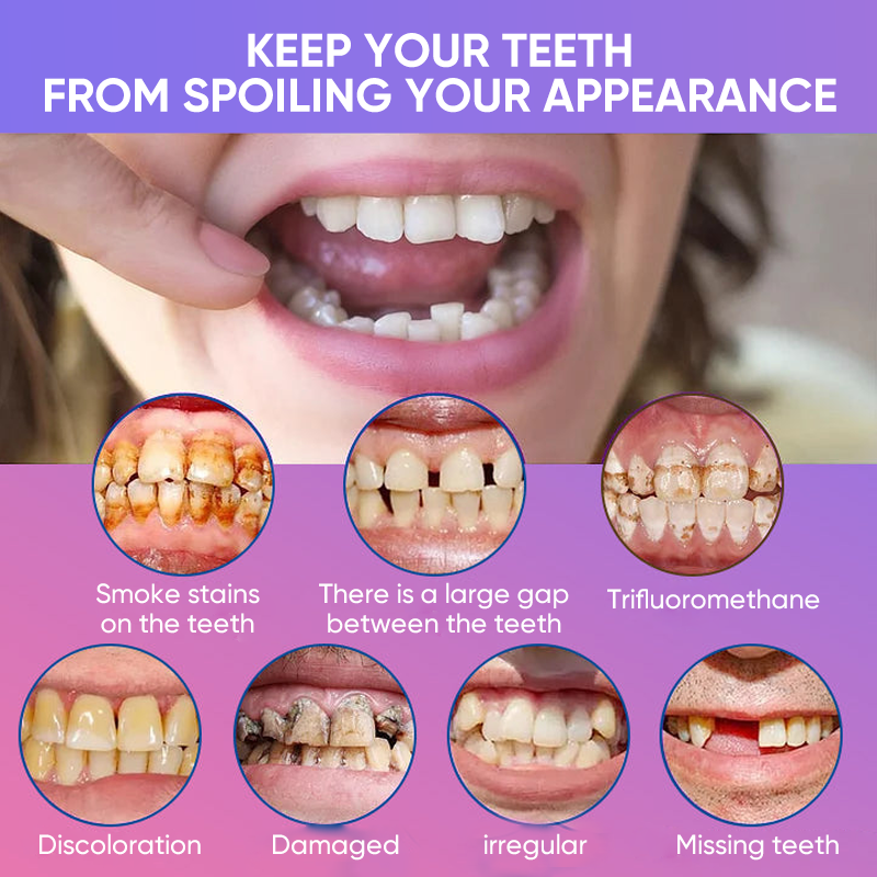 Denture Decoration Set