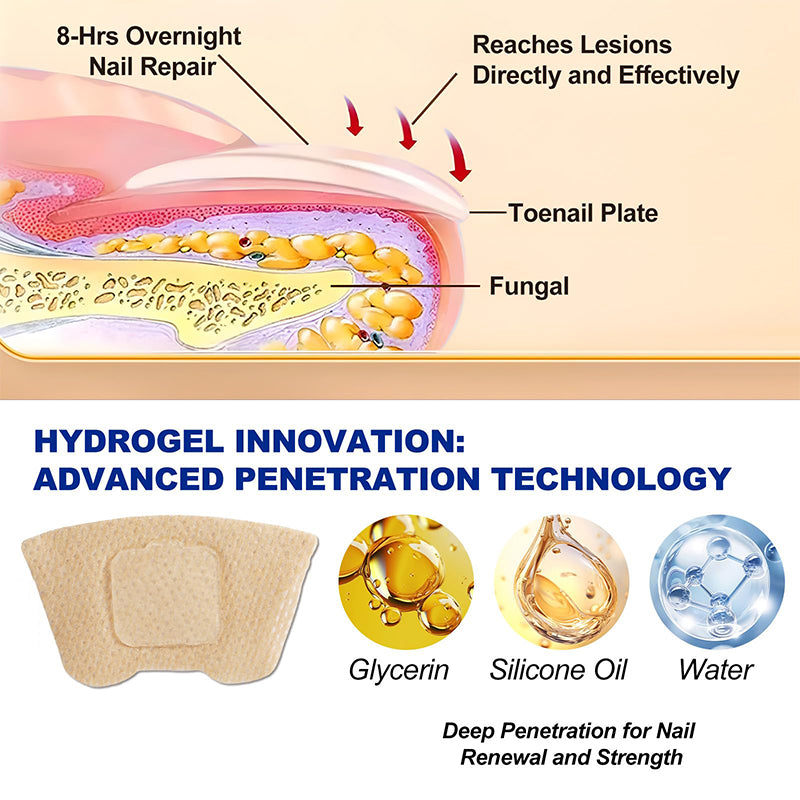 Fungal Nail Patches