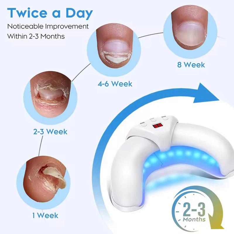 2025 New Nail Fungus Cleaning Device for Multiple Toenails & Fingernails