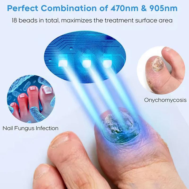 2025 New Nail Fungus Cleaning Device for Multiple Toenails & Fingernails