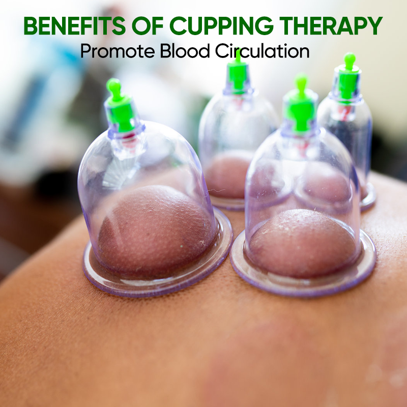 Cupping Kit for Massage Therapy