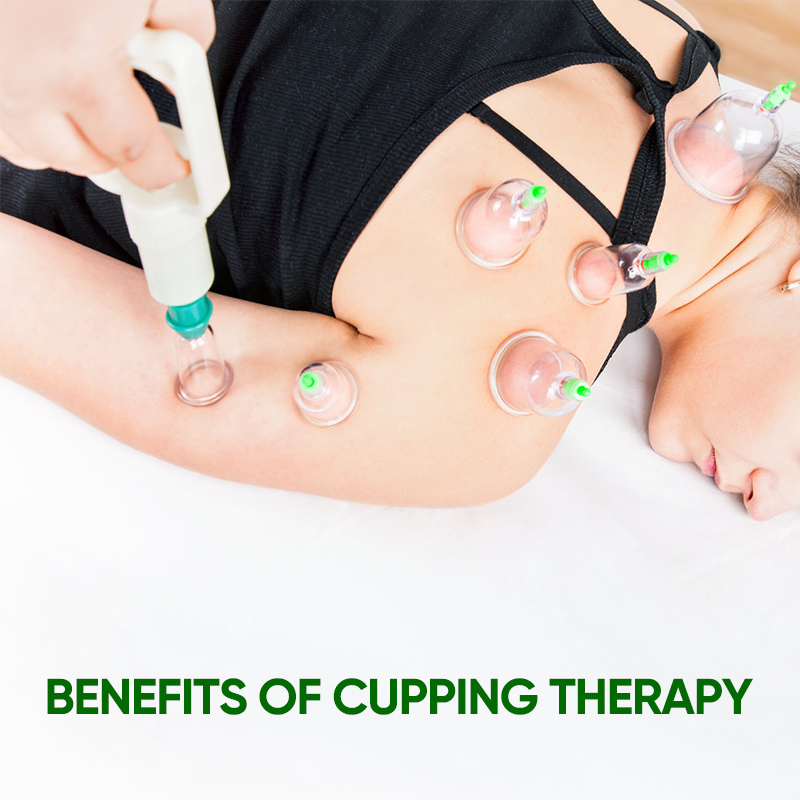 Cupping Kit for Massage Therapy
