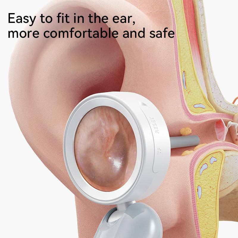 Wireless Ear Otoscope
