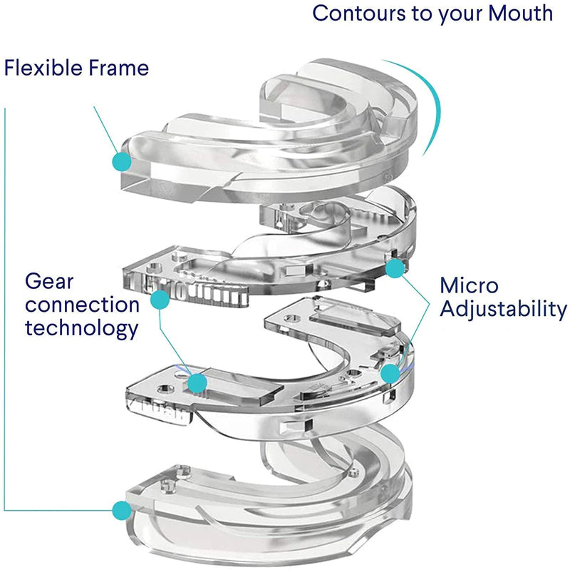 Stop Snoring Braces