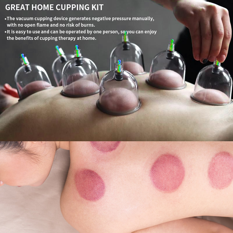 Cupping Kit for Massage Therapy