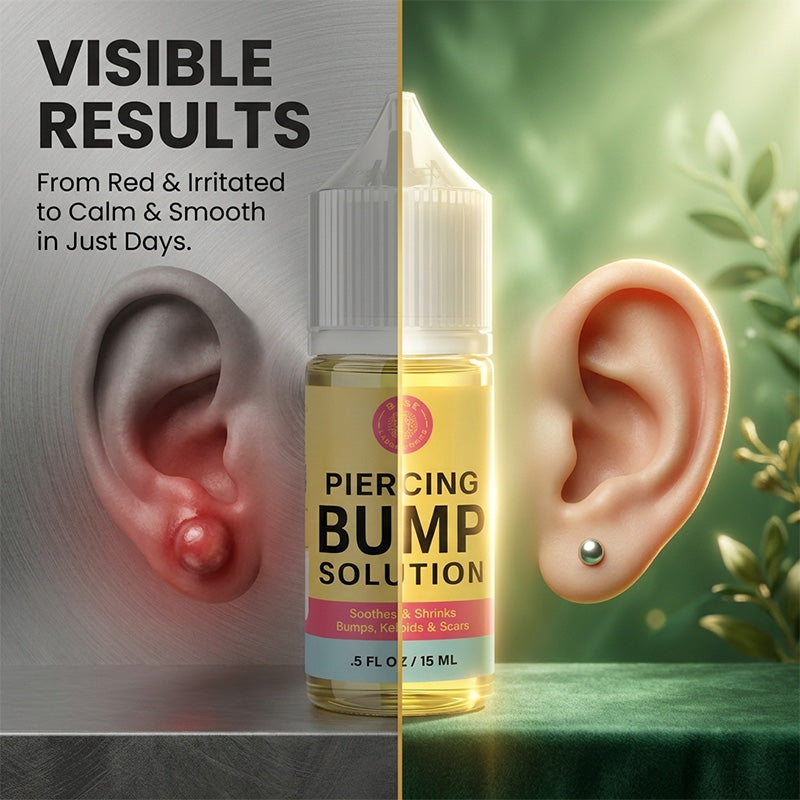 Natural Piercing Bump Repair Serum
