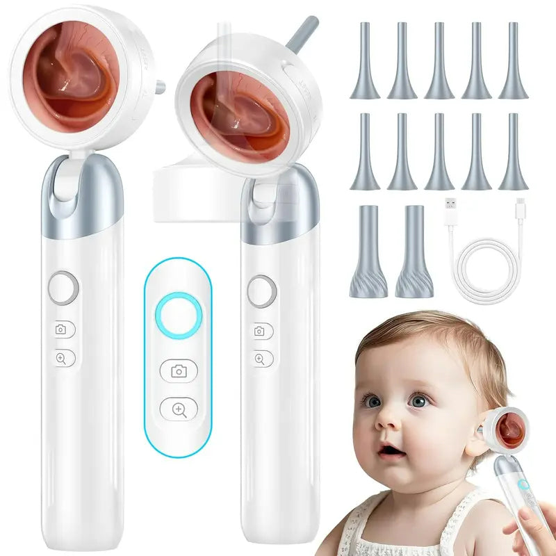 Wireless Ear Otoscope