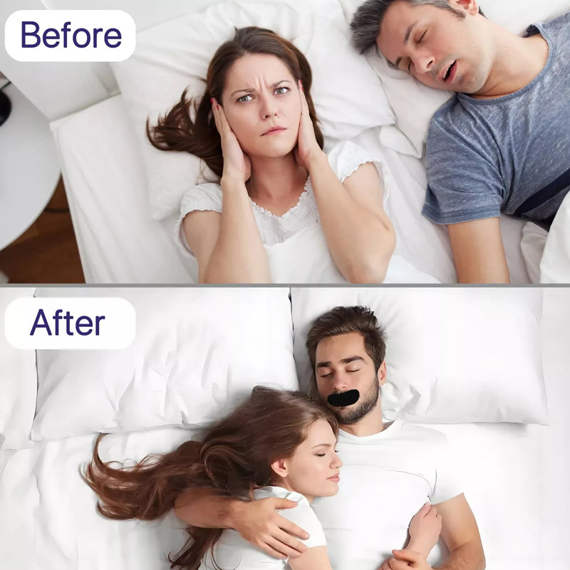 Anti-Snoring Mouth Tape
