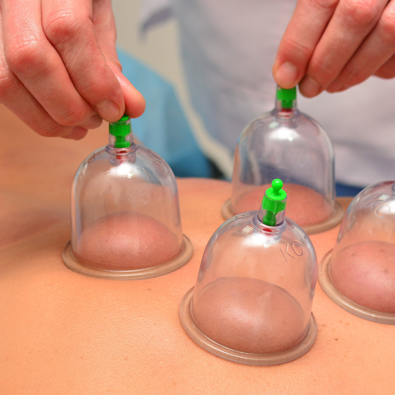 Cupping Kit for Massage Therapy