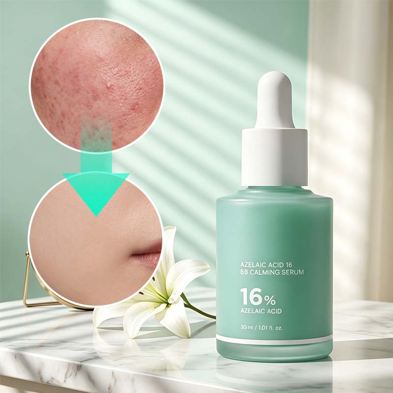 Azelaic Acid 16% Calming Serum