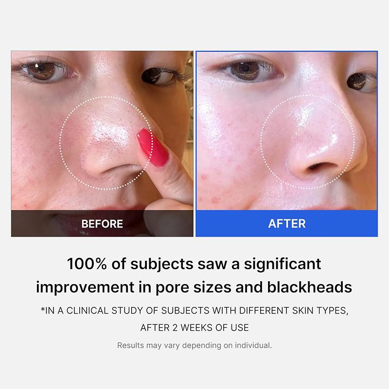 Zero Pore Dual-Texture Exfoliating Toner Pads