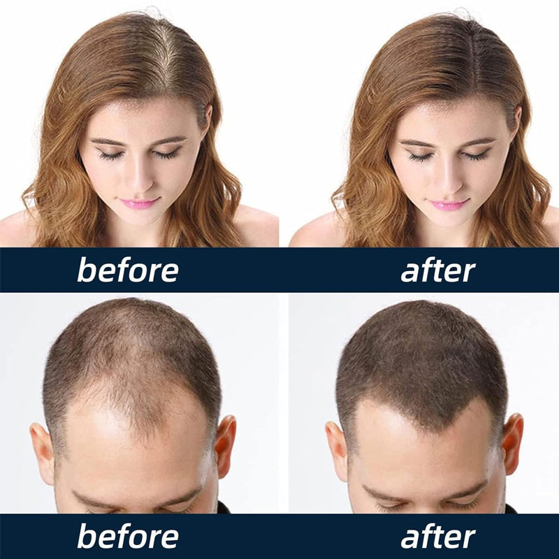 Men's Hair Growth Serum