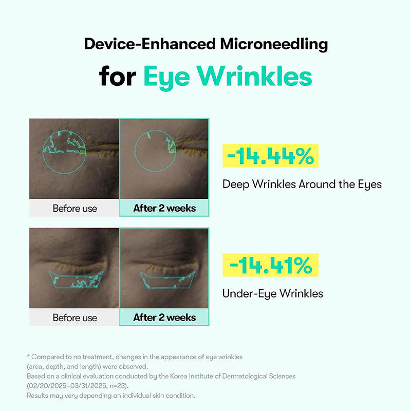 Micro-Vibration Anti-Aging Eye Cream
