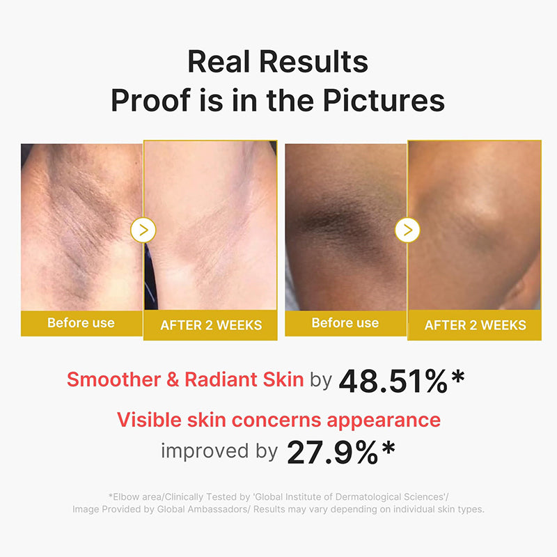Kojic Acid and Turmeric Essence Serum