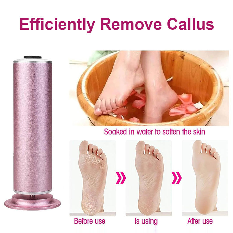 Electric Foot Callus Remover