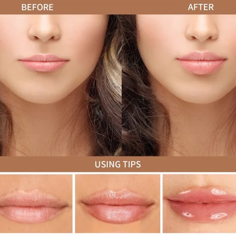 Lip Augmenter