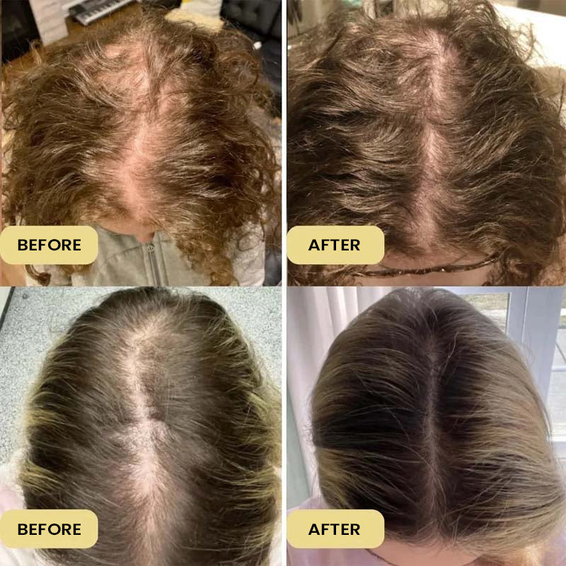 Rosemary Hair Care Essential Oil