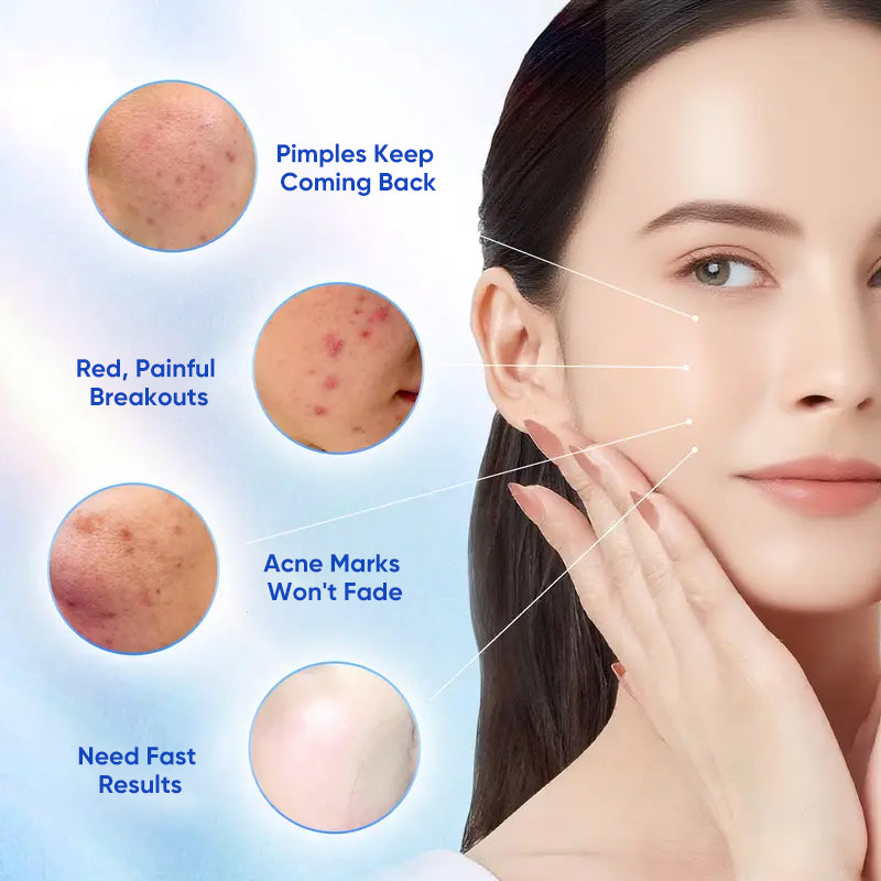 Salicylic Acid Acne Spot Treatment Serum – 10ml