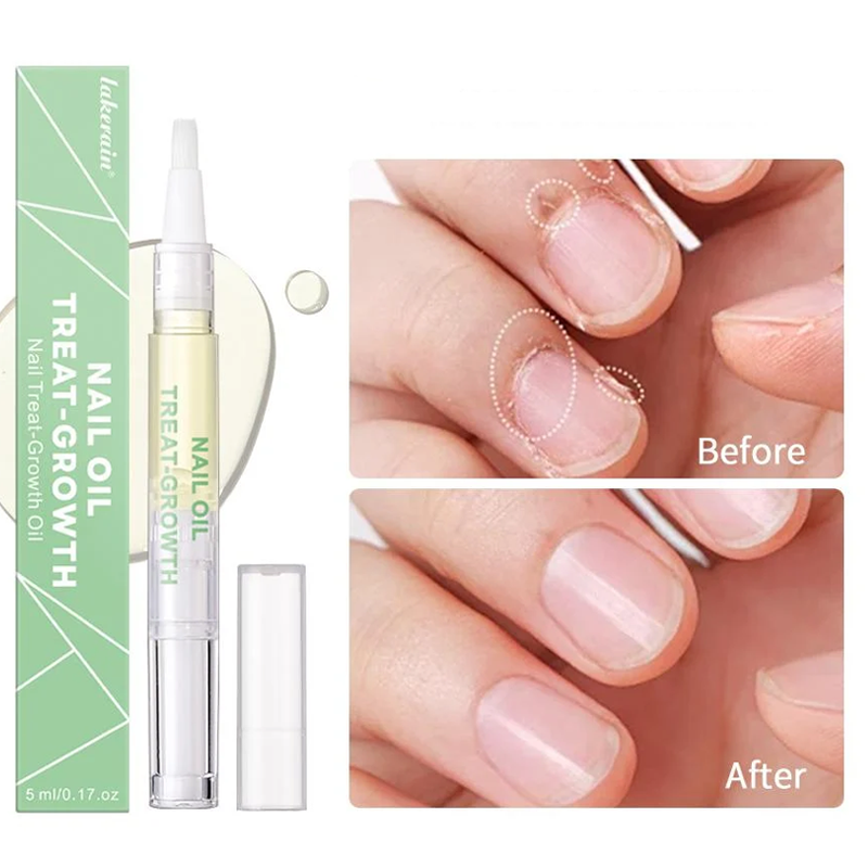 Nail Growth Oil