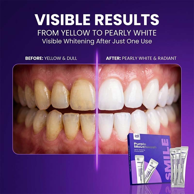 Fresh Breath Mouthwash Sachets