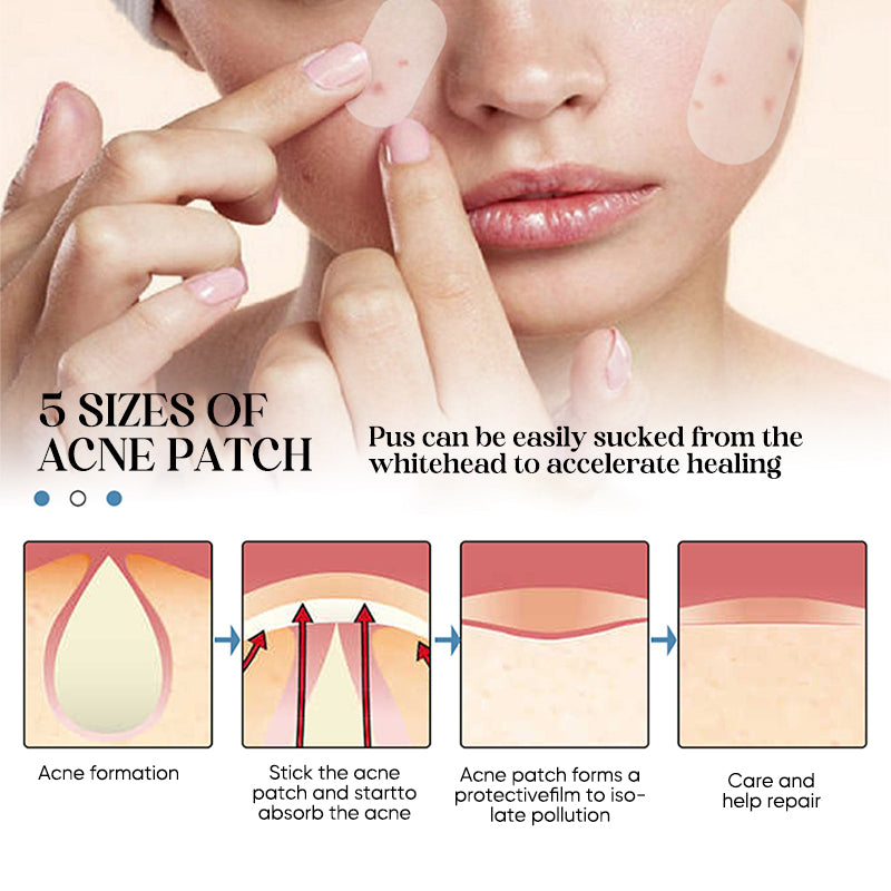 Acne Patches