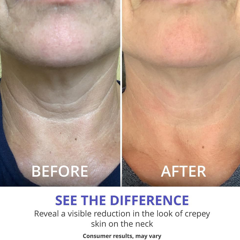 Neck Firming Cream
