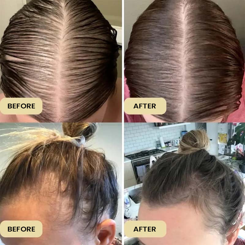 Rosemary Hair Care Essential Oil