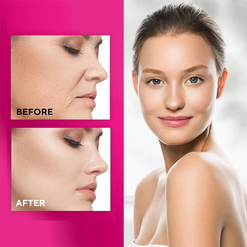 Silicone Face and Forehead Wrinkle Patches