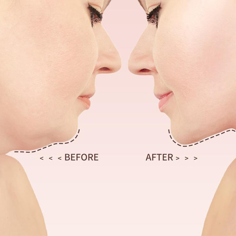 Lifting and firming face slimming bandage