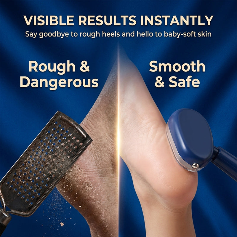 Foot callus remover