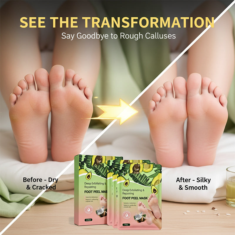 Smooth Feet Exfoliating Foot Peel