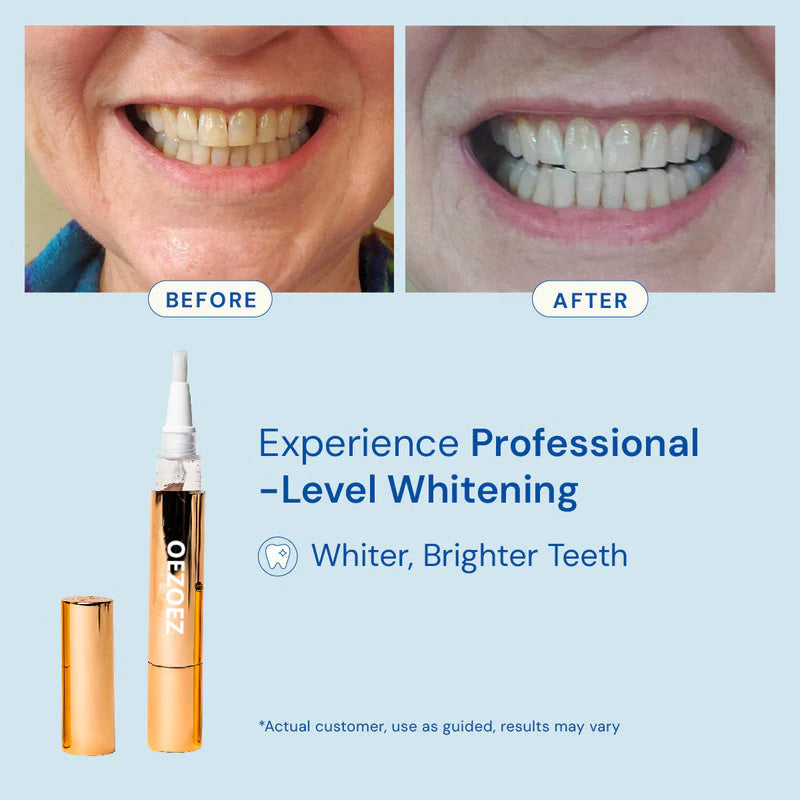 Snow Extra-Strength Teeth Whitening Serum