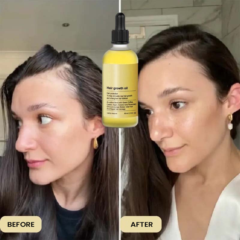 Rosemary Hair Care Essential Oil
