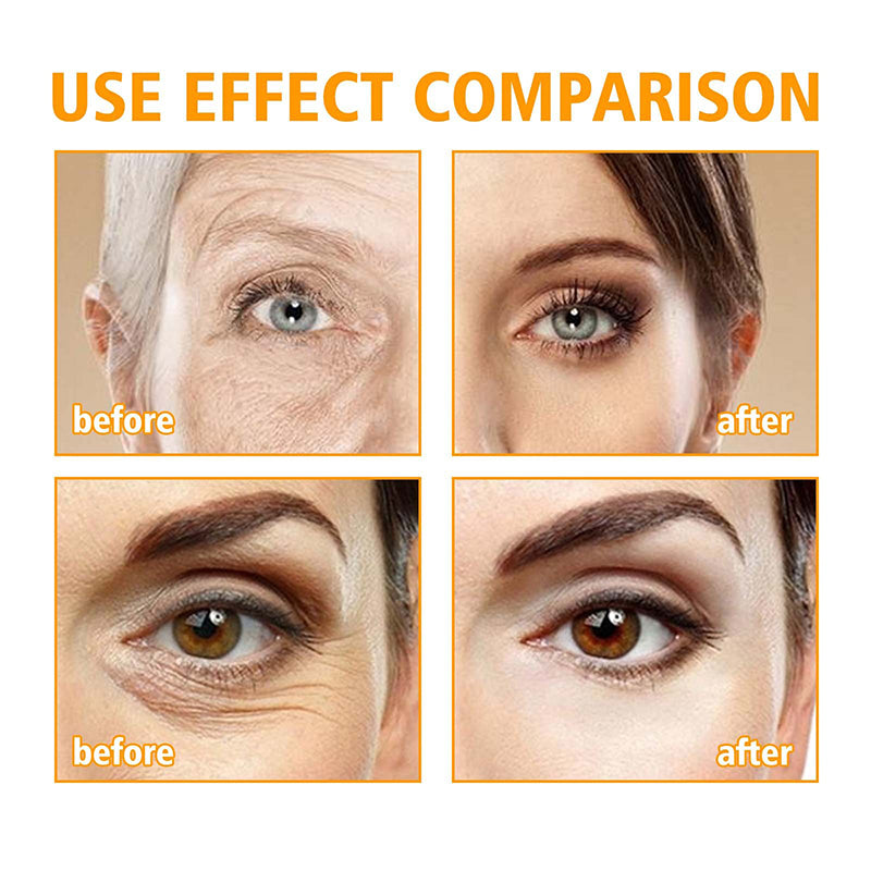 Eye Care Cream