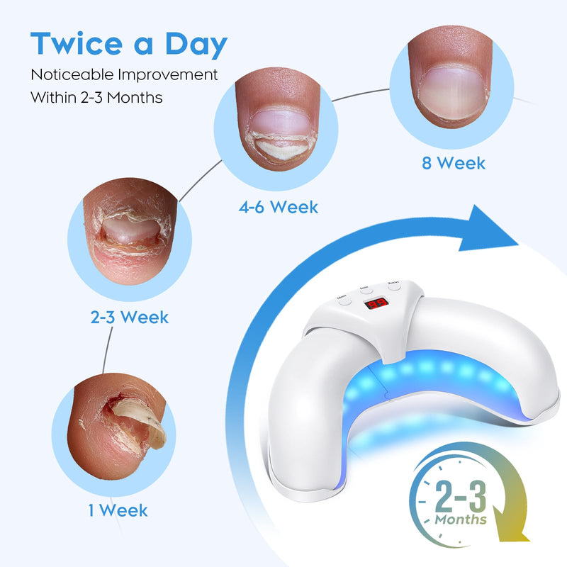 2025 New Nail Fungus Cleaning Device for Multiple Toenails & Fingernails