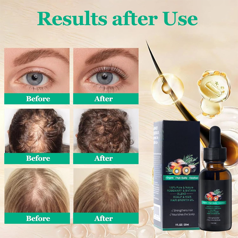 Strengthening Hair Oil for Resilient Hair
