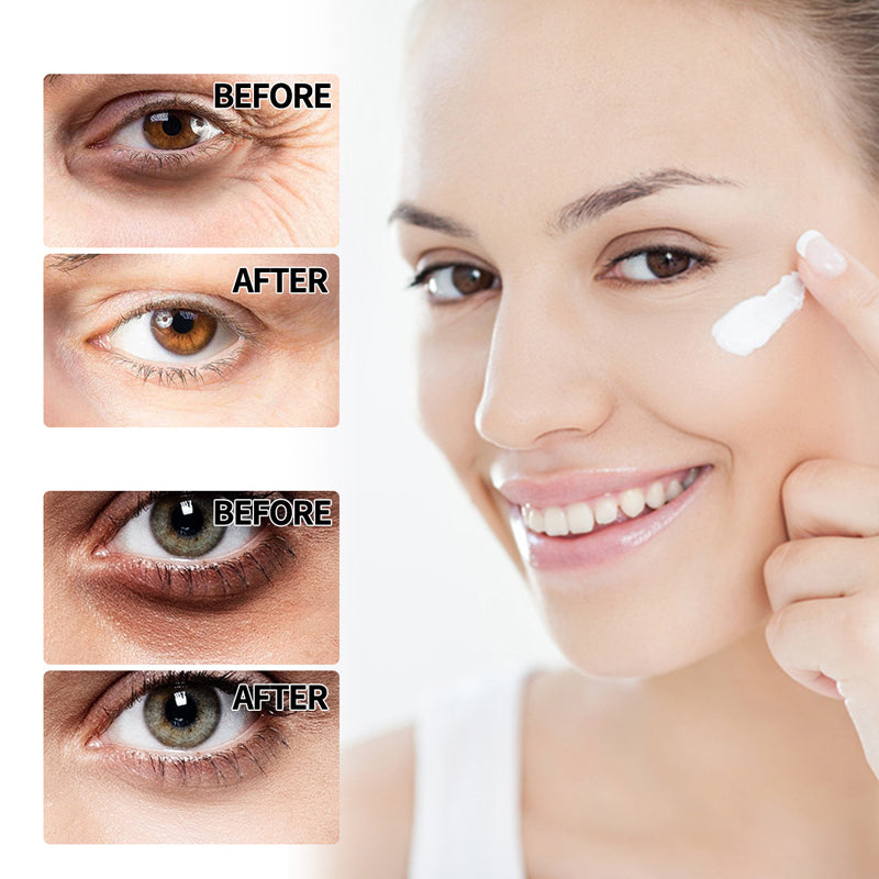 Retinol Eye Cream Stick