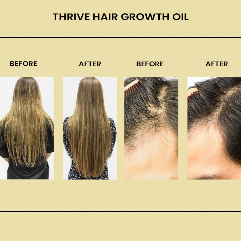 Rosemary Hair Care Essential Oil