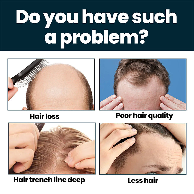 Men's Hair Growth Serum