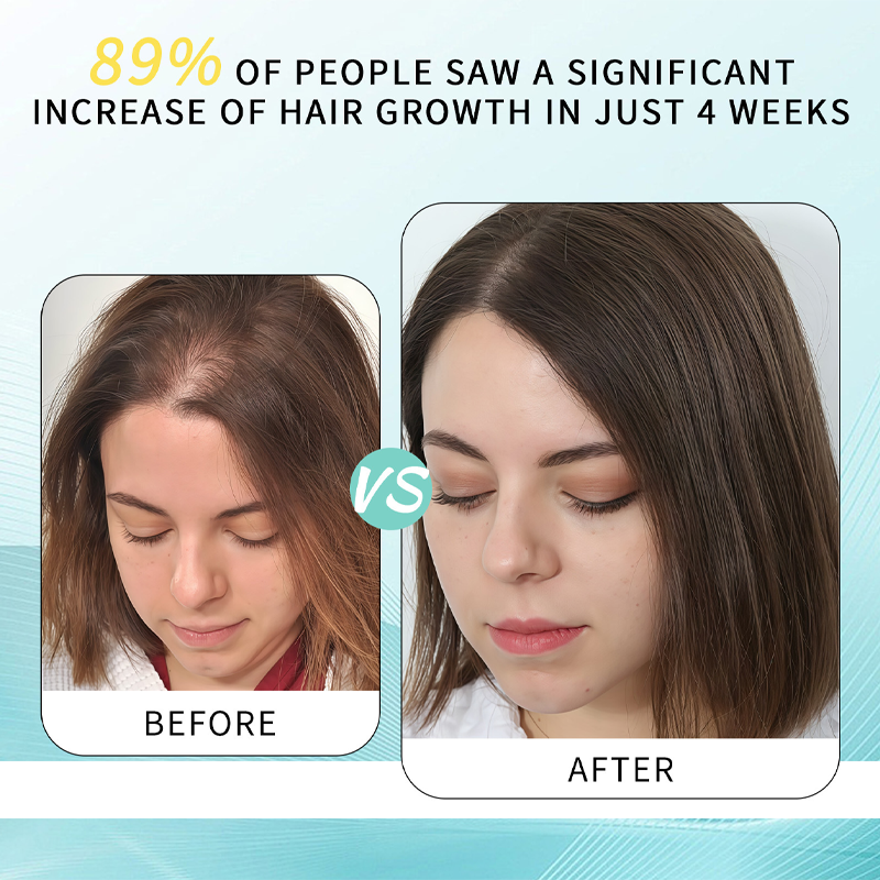 Hair Conditioning Lotion