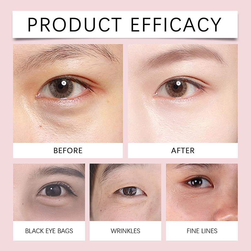 Electric Massage Eye Cream for Dark Circle