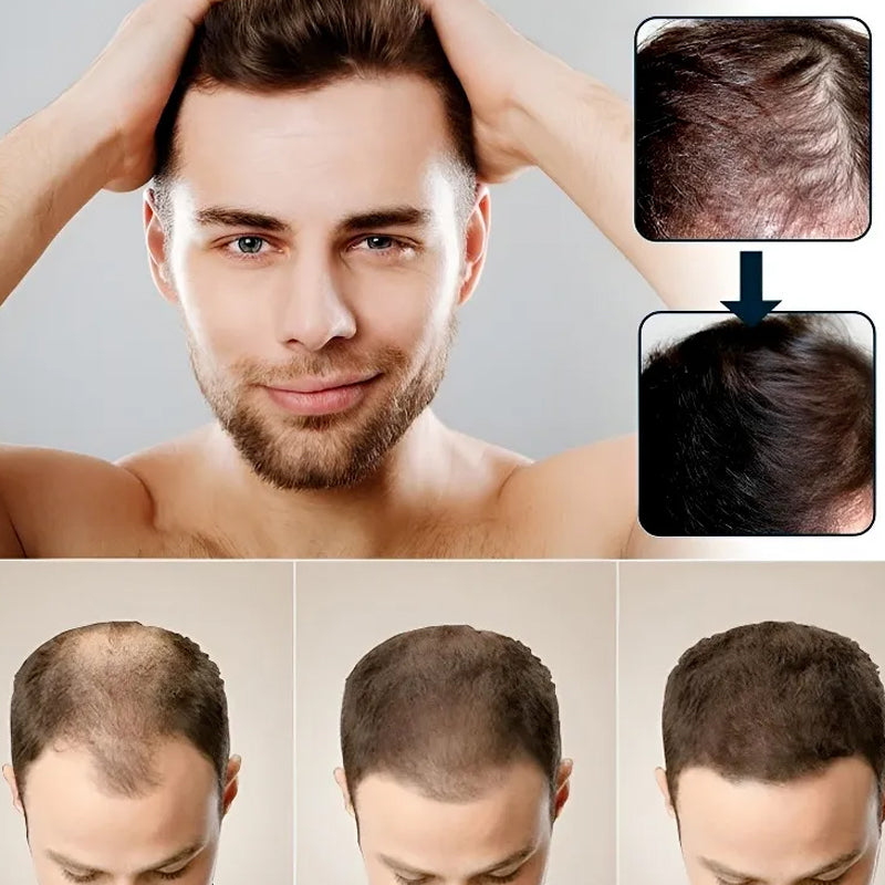Men's Hair Growth Serum