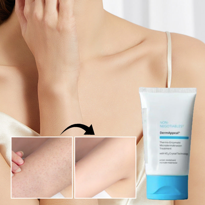 Derm Appeal Microdermabrasion Treatment