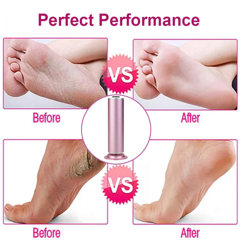 Electric Foot Callus Remover