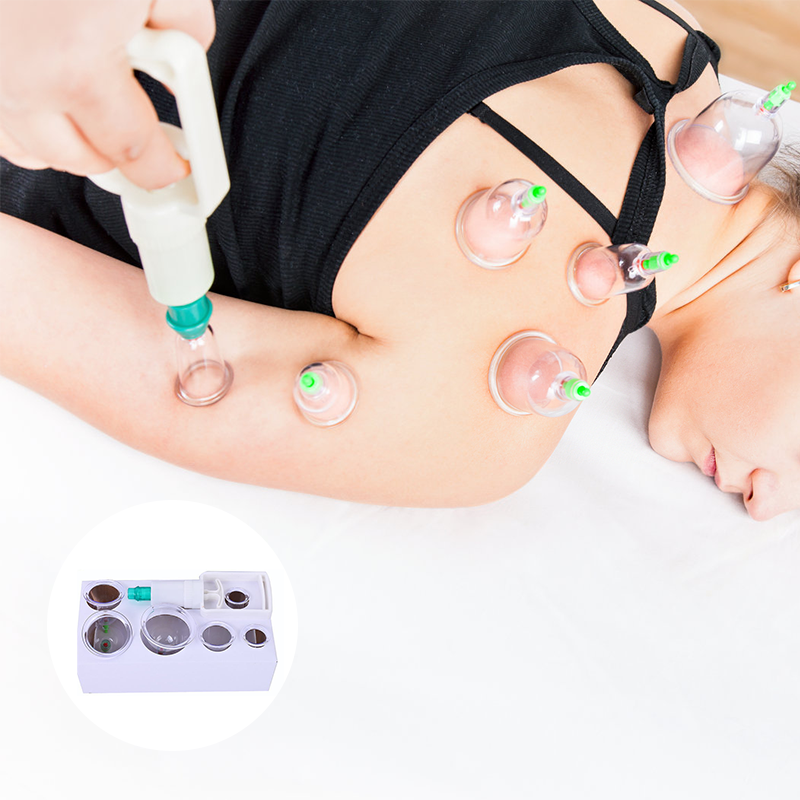 Cupping Kit for Massage Therapy