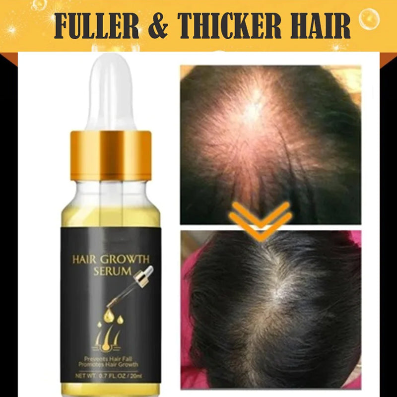 Biotin Thickening Herbal Serum