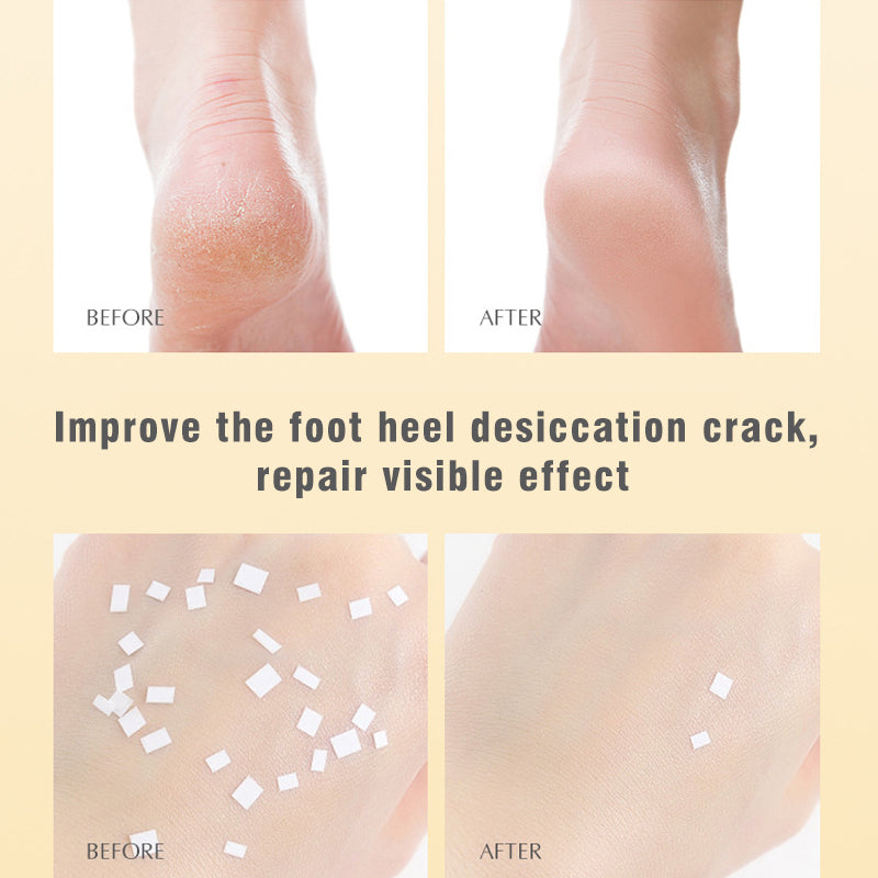 Heel Chafing Anti-freeze Anti-crack Repair Hydration Care Oil