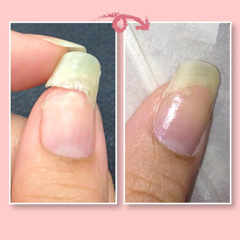 NAIL REPAIR PROTECTION GEL