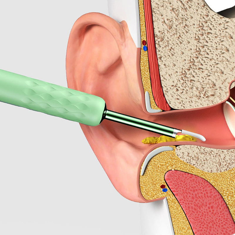 Ear Cleaner with Camera Endoscope