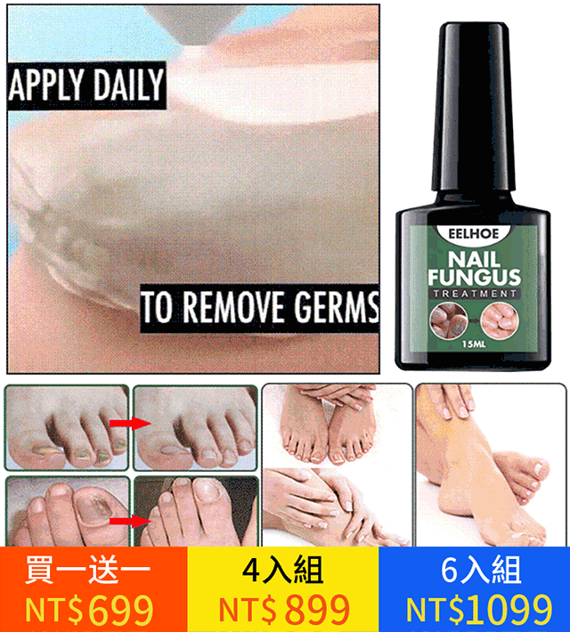 Fungal Nail Treatment